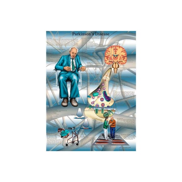 Fabrication Enterprises 3B Anatomical Chart - Parkinson's Disease, Paper 12-4616P - main